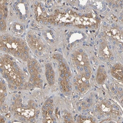 Invitrogen GAB3 Polyclonal Antibody 100 &mu;L; Unconjugated:Antikörper