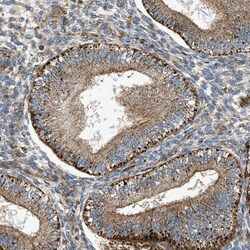 Invitrogen DHODH Polyclonal Antibody 100 &mu;L; Unconjugated:Antibodies,