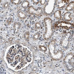 Invitrogen DHODH Polyclonal Antibody 100 &mu;L; Unconjugated:Antibodies,