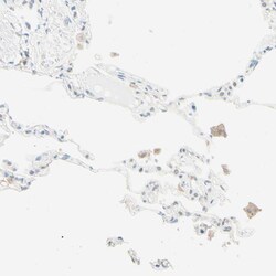 Invitrogen UPK3B Polyclonal Antibody 100 &mu;L; Unconjugated:Antibodies,