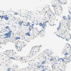 Invitrogen UPK3B Polyclonal Antibody 100 &mu;L; Unconjugated:Antibodies,