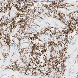 Invitrogen MFAP5 Polyclonal Antibody 100 &mu;L; Unconjugated:Antibodies,