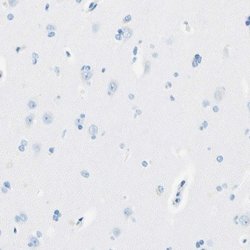 Invitrogen MFAP5 Polyclonal Antibody 100 &mu;L; Unconjugated:Antibodies,