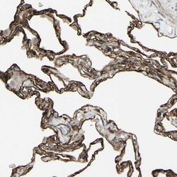 Invitrogen DTX3L Polyclonal Antibody 100 &mu;L; Unconjugated:Antibodies,