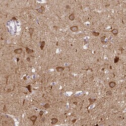Invitrogen C12orf53 Polyclonal Antibody 100 &mu;L; Unconjugated:Antibodies,