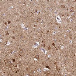 Invitrogen C12orf53 Polyclonal Antibody 100 &mu;L; Unconjugated:Antibodies,