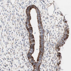 Invitrogen AGPAT5 Polyclonal Antibody 100 &mu;L; Unconjugated:Antibodies,