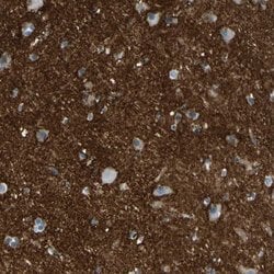 Invitrogen ATP1B2 Polyclonal Antibody 100 &mu;L; Unconjugated:Antibodies,