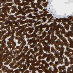 Invitrogen MGST2 Polyclonal Antibody 100 &mu;L; Unconjugated:Antibodies,