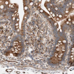 Invitrogen C1orf43 Polyclonal Antibody 100 &mu;L; Unconjugated:Antibodies,