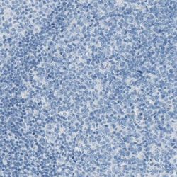 Invitrogen DCT Polyclonal Antibody 100 &mu;L; Unconjugated:Antibodies,