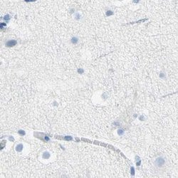 Invitrogen DCT Polyclonal Antibody 100 &mu;L; Unconjugated:Antibodies,