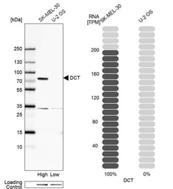 Invitrogen DCT Polyclonal Antibody 100 &mu;L; Unconjugated:Antibodies,