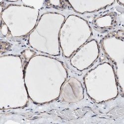 Invitrogen LRIG3 Polyclonal Antibody 100 &mu;L; Unconjugated:Antibodies,
