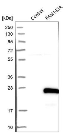 Invitrogen FAM163A Polyclonal Antibody 100 &mu;L | Buy Online | Invitrogen&trade; | Fisher Scientific
