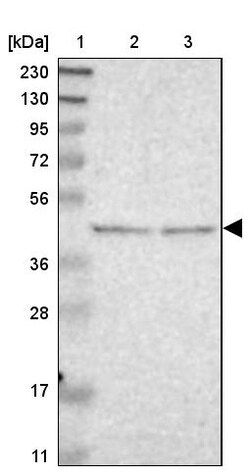 Invitrogen B4GALT3 Polyclonal Antibody 100 &mu;L | Buy Online | Invitrogen&trade; | Fisher Scientific
