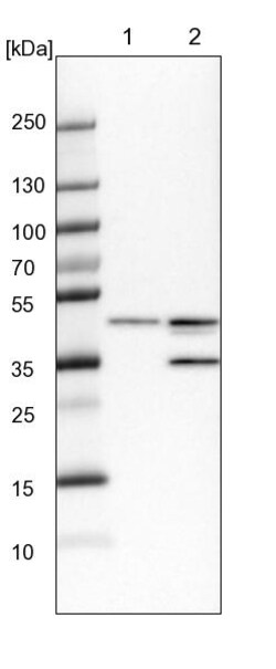 Invitrogen B4GALT3 Polyclonal Antibody 100 &mu;L | Buy Online | Invitrogen&trade; | Fisher Scientific