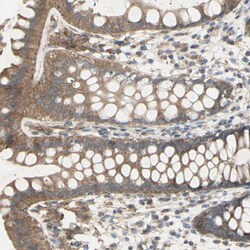 Invitrogen IGSF9B Polyclonal Antibody 100 &mu;L; Unconjugated:Antibodies,