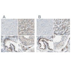 Invitrogen B4GALT1 Polyclonal Antibody 100 &mu;L | Buy Online | Invitrogen&trade; | Fisher Scientific