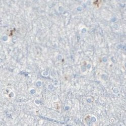 Invitrogen B4GALT1 Polyclonal Antibody 100 &mu;L | Buy Online | Invitrogen&trade; | Fisher Scientific