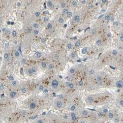 Invitrogen B4GALT1 Polyclonal Antibody 100 &mu;L | Buy Online | Invitrogen&trade; | Fisher Scientific