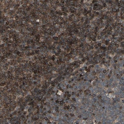 Invitrogen Dysadherin Polyclonal Antibody 100 &mu;L; Unconjugated:Antibodies,