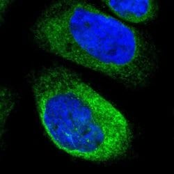 Invitrogen Dysadherin Polyclonal Antibody 100 &mu;L; Unconjugated:Antibodies,
