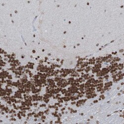 Invitrogen PHF2 Polyclonal Antibody 100 &mu;L; Unconjugated:Antibodies,