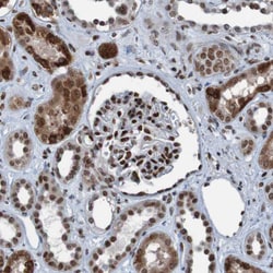 Invitrogen PHF2 Polyclonal Antibody 100 &mu;L; Unconjugated:Antibodies,