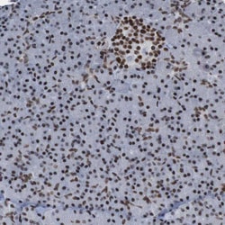 Invitrogen PHF2 Polyclonal Antibody 100 &mu;L; Unconjugated:Antibodies,