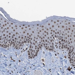 Invitrogen PHF2 Polyclonal Antibody 100 &mu;L; Unconjugated:Antibodies,