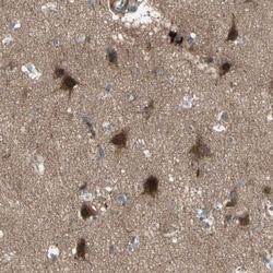Invitrogen OSTM1 Polyclonal Antibody 100 &mu;L; Unconjugated:Antibodies,