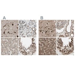 Invitrogen MLF2 Polyclonal Antibody 100 &mu;L; Unconjugated:Antibodies,