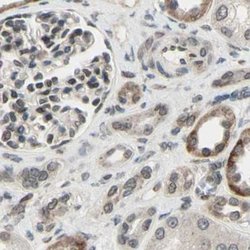 Invitrogen MLF2 Polyclonal Antibody 100 &mu;L; Unconjugated:Antibodies,