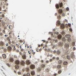 Invitrogen MLF2 Polyclonal Antibody 100 &mu;L; Unconjugated:Antibodies,