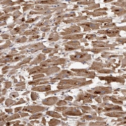 Invitrogen MGAT5 Polyclonal Antibody 100 &mu;L | Buy Online | Invitrogen&trade; | Fisher Scientific