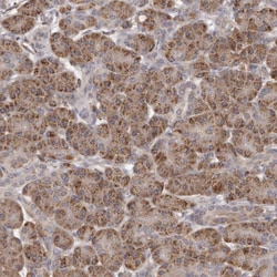 Invitrogen MGAT5 Polyclonal Antibody 100 &mu;L | Buy Online | Invitrogen&trade; | Fisher Scientific