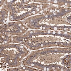 Invitrogen MGAT5 Polyclonal Antibody 100 &mu;L | Buy Online | Invitrogen&trade; | Fisher Scientific