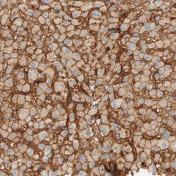 Invitrogen Stomatin Polyclonal Antibody 100 &mu;L; Unconjugated:Antibodies,