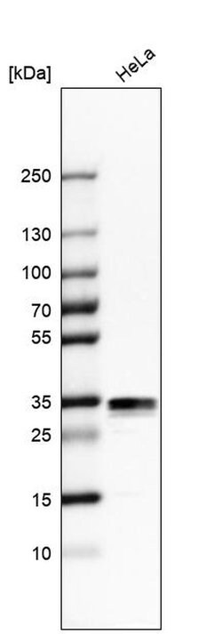 Invitrogen Stomatin Polyclonal Antibody 100 &mu;L; Unconjugated:Antibodies,