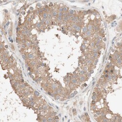 Invitrogen CCDC67 Polyclonal Antibody 100 &mu;L; Unconjugated:Antibodies,