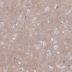 Invitrogen SYT12 Polyclonal Antibody 100 &mu;L; Unconjugated:Antibodies,