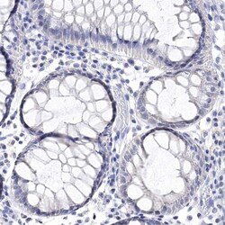 Invitrogen SYT12 Polyclonal Antibody 100 &mu;L; Unconjugated:Antibodies,