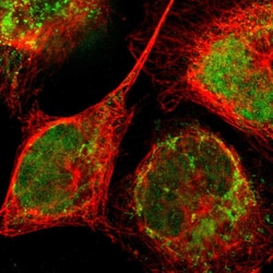 Invitrogen ZNF782 Polyclonal Antibody 100 &mu;L; Unconjugated:Antibodies,