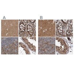 Invitrogen ARHGEF11 Polyclonal Antibody 100 &mu;L; Unconjugated:Antibodies,