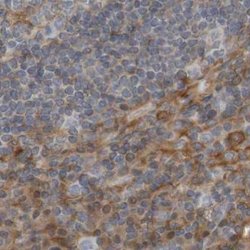 Invitrogen ARHGEF11 Polyclonal Antibody 100 &mu;L; Unconjugated:Antibodies,
