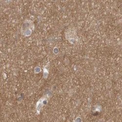 Invitrogen ARHGEF11 Polyclonal Antibody 100 &mu;L; Unconjugated:Antibodies,