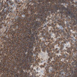 Invitrogen SPINK6 Polyclonal Antibody 100 &mu;L; Unconjugated:Antibodies,