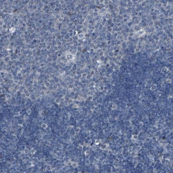 Invitrogen LRRN1 Polyclonal Antibody 100 &mu;L; Unconjugated:Antibodies,