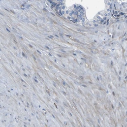 Invitrogen LRRN1 Polyclonal Antibody 100 &mu;L; Unconjugated:Antibodies,